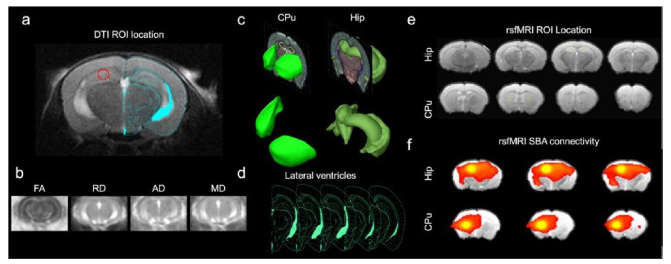 Early Stage Alterations in White Matter and Decreased Functional Interhemispheric Hippocampal Connectivity in the 3xTg Mouse Model of Alzheimer’s Disease